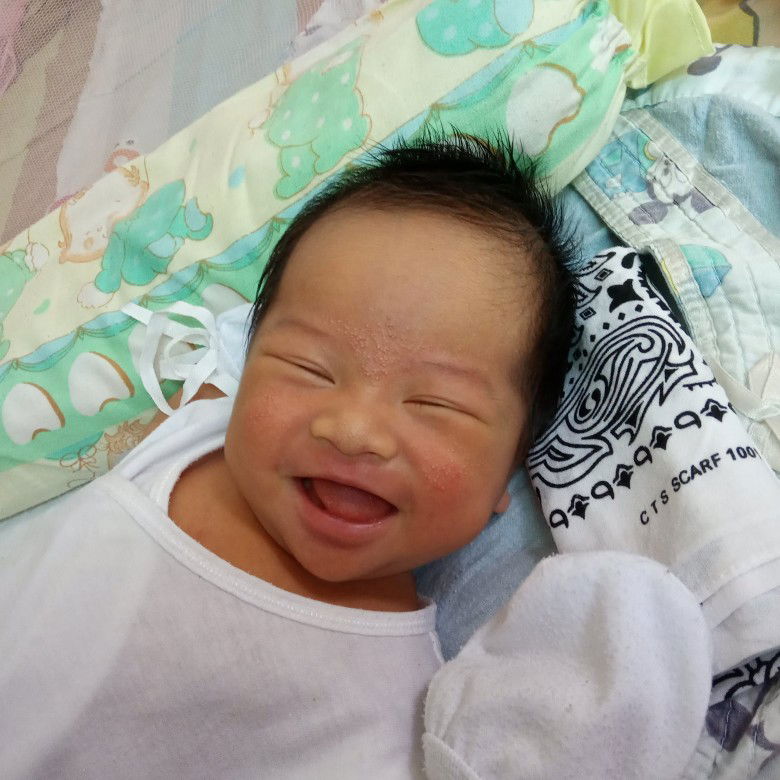 butlig sa mukha ni baby