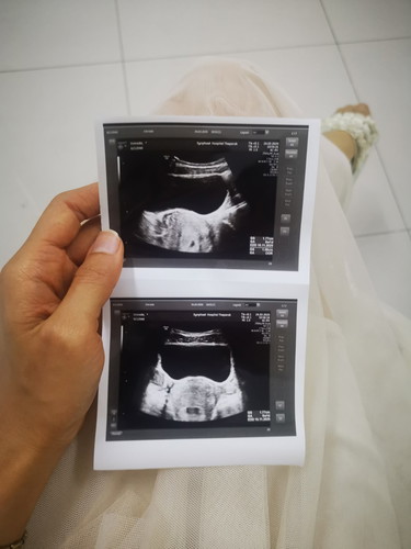 ไปฝากครรภ์แต่รพ.ไม่รับฝาก กลัวแม่เป็นโควิด-19