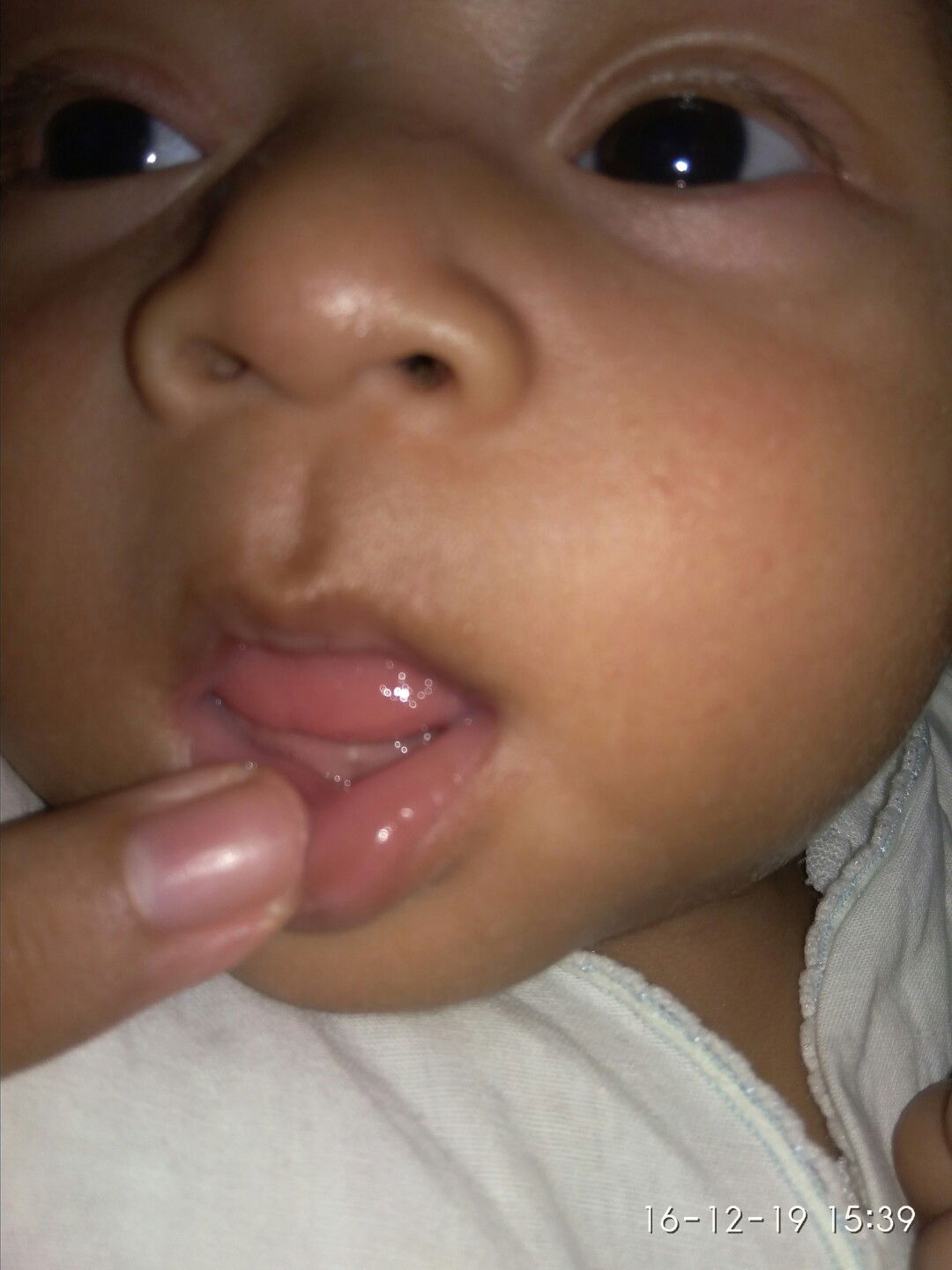 Timbuh gigi atau bekas susu?