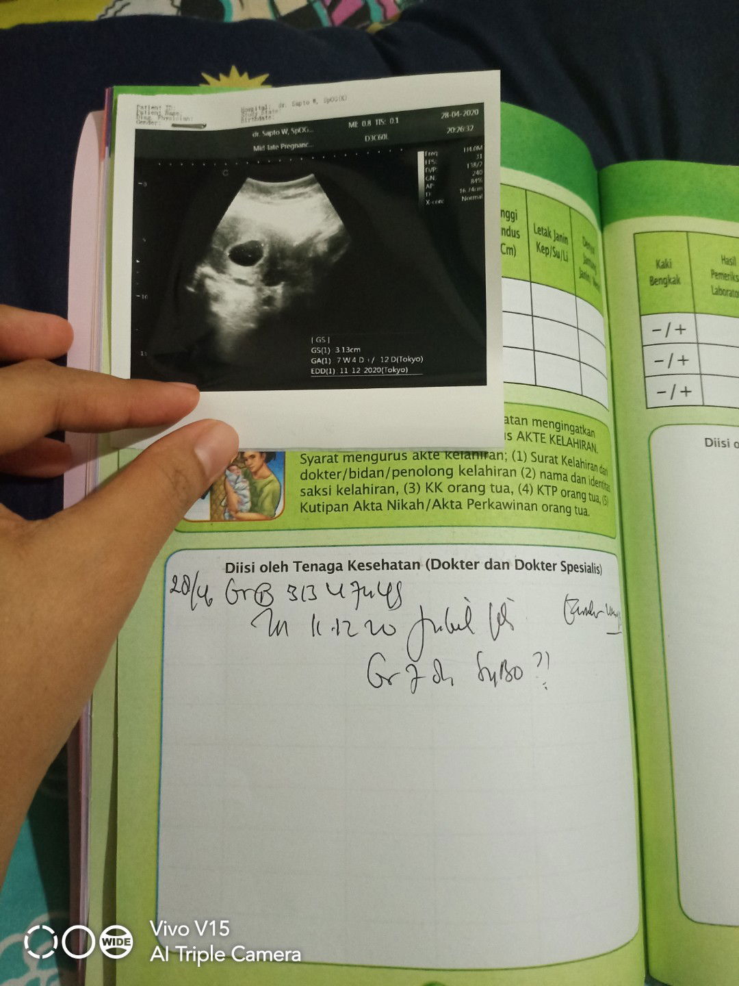 janin belum terlihat