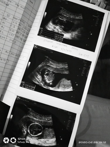 my second baby