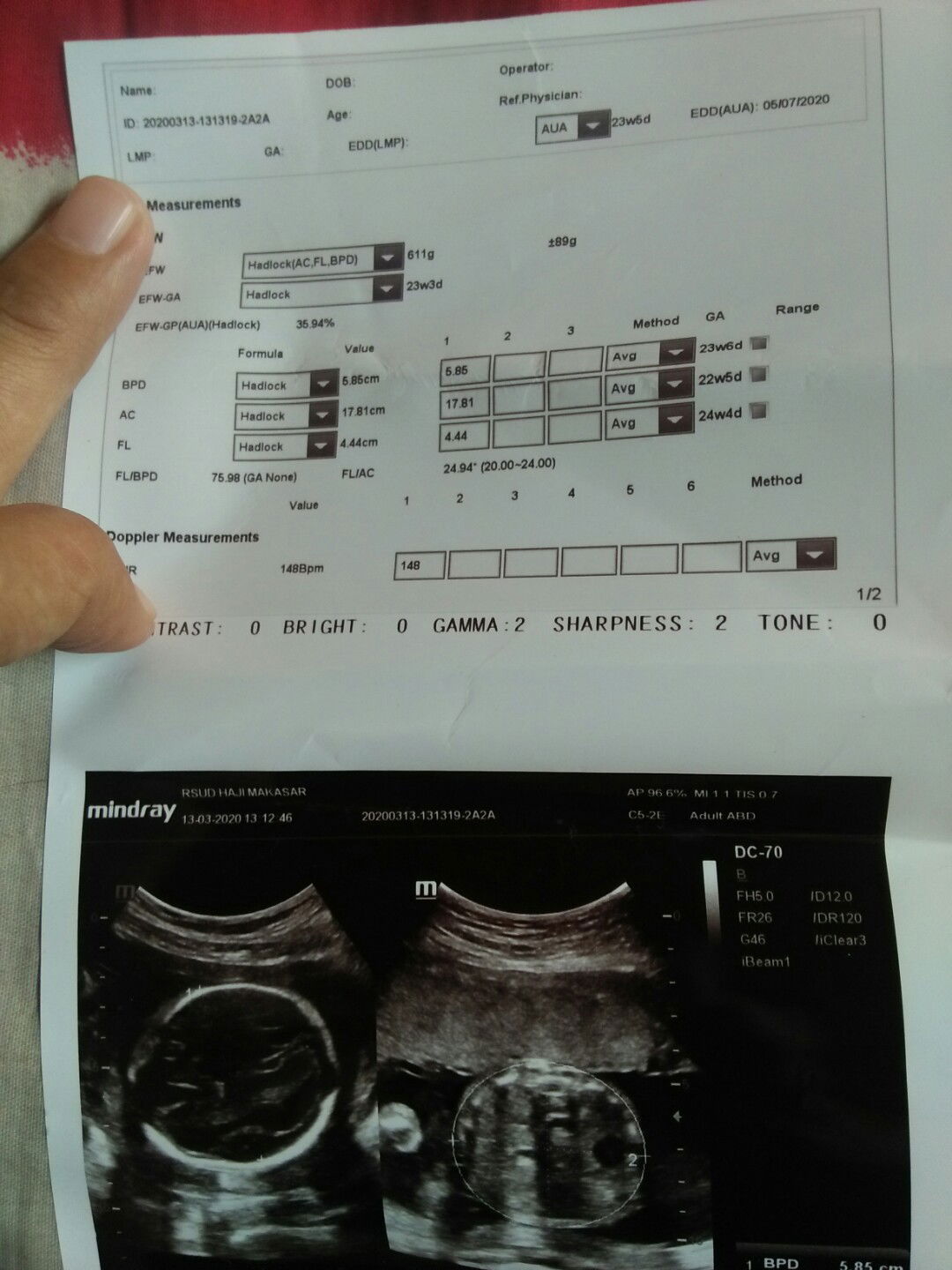 hamil 24 week nyeri perut kiri.