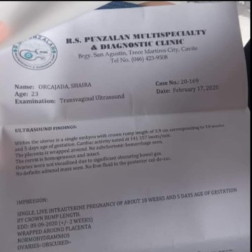 Ilang weeks na??