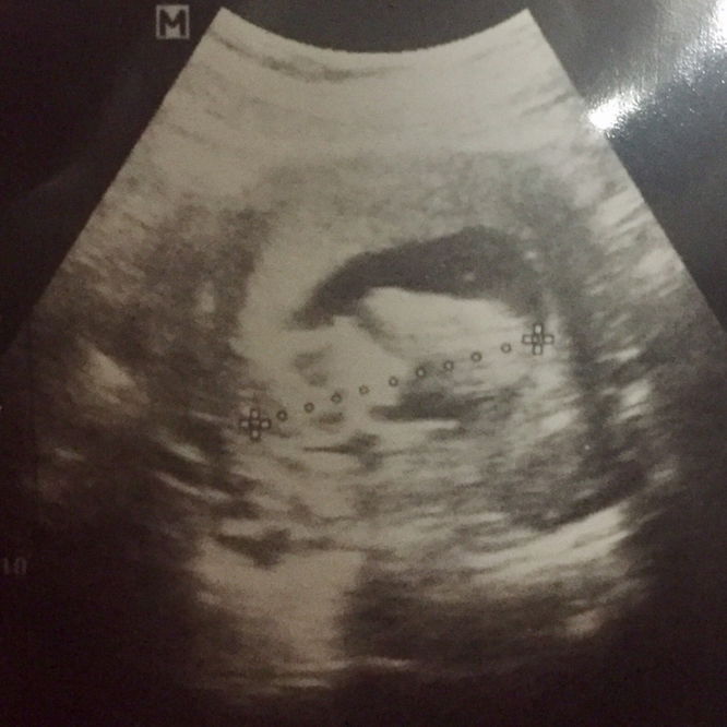 แม่ๆช่วยดูหน่อยค่ะ