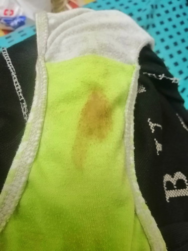 Brownish Discharge