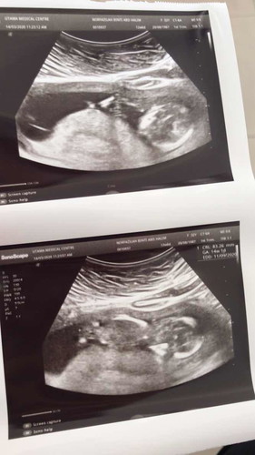 hai My babybump is already 15week