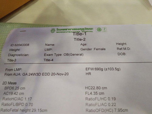 สอบถามแม่ๆคะ