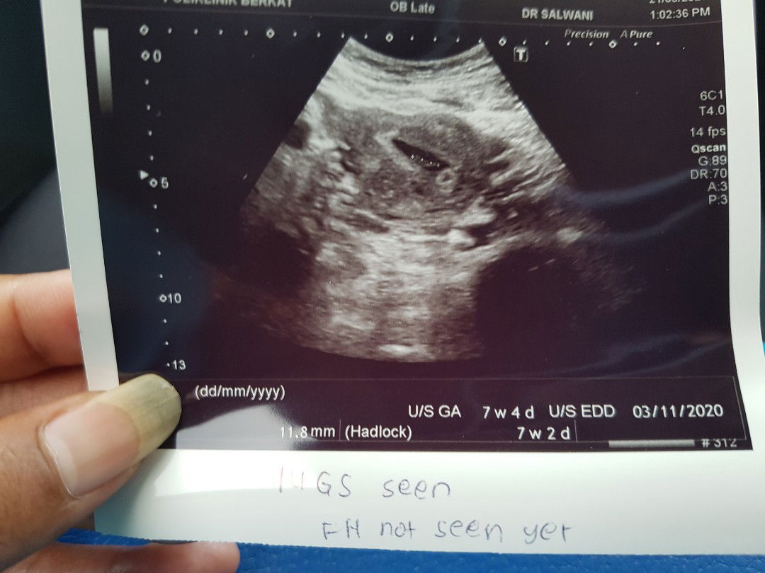 hasil kiraan 5 minggu 4 hari