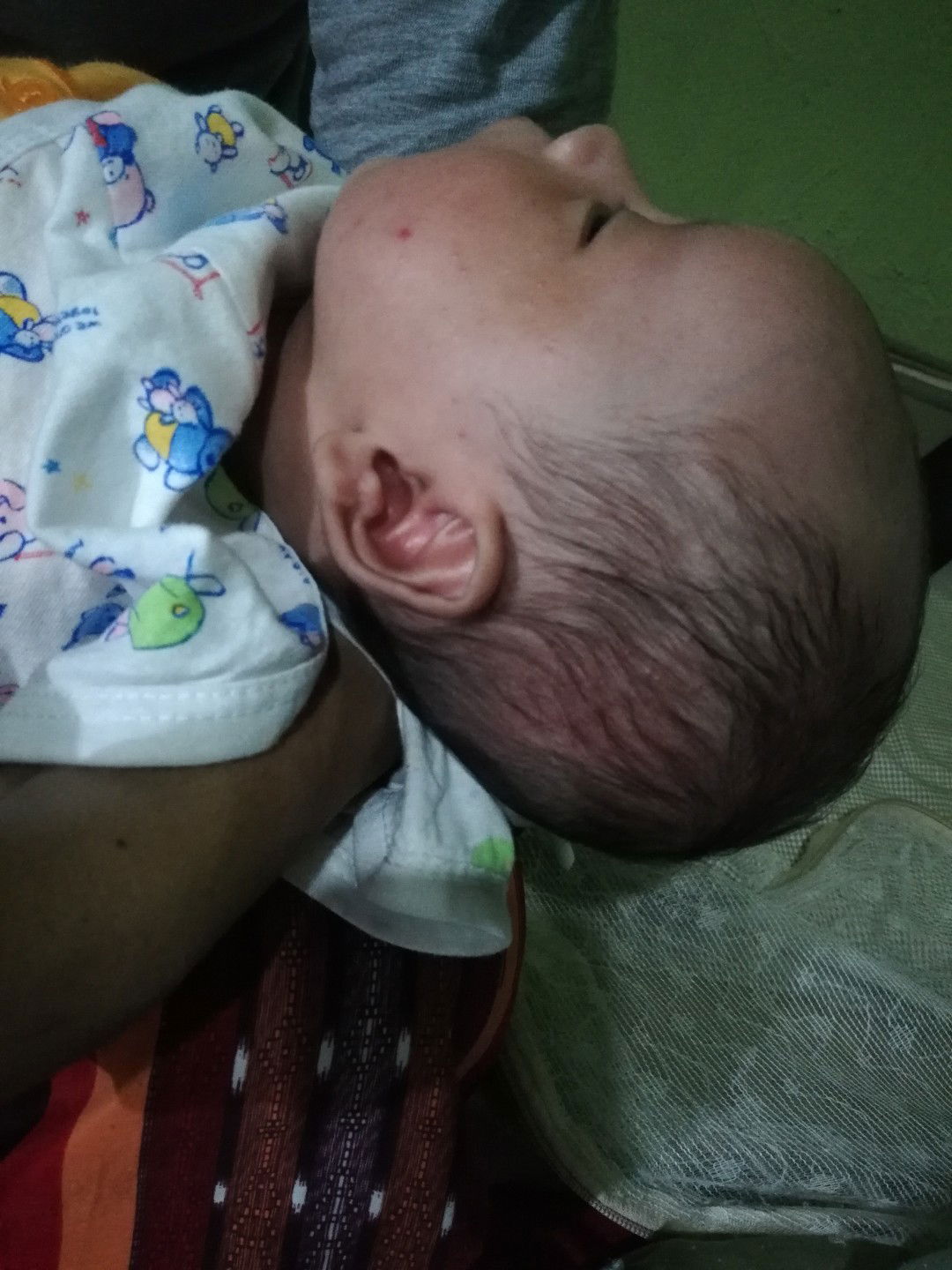 Bintik Merah Dmuka, Kepala