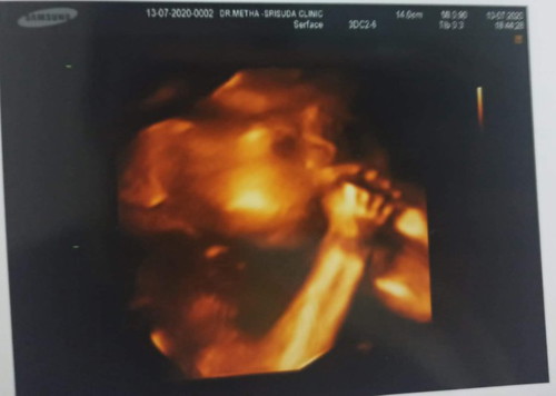 24W3D