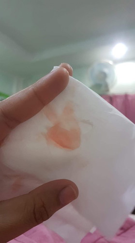 แบบนี้เป็นอะไรค่ะ