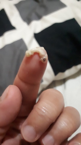 cervical mucus po. 9 weeks 3 days