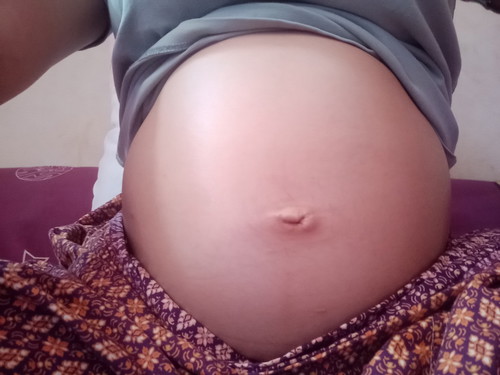 20W2D