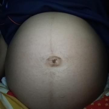 ท้องแรกจ้า 24w3d ได้น้องแฝด