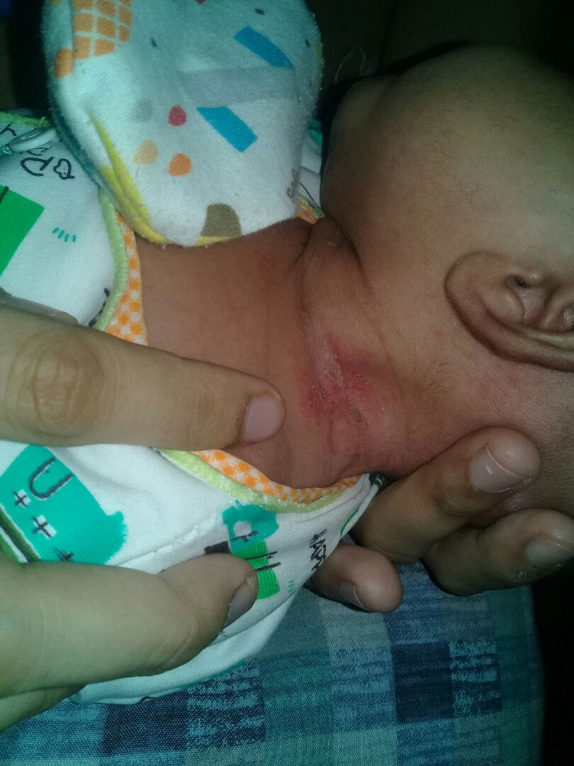 Obatnya apa selain harus Ke DSA