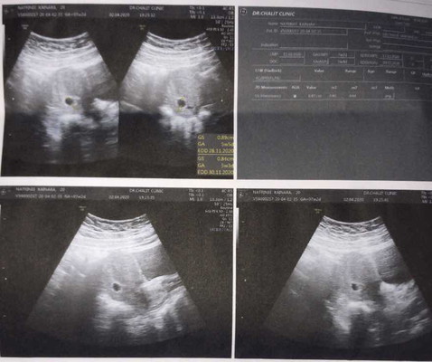 ถามหน่อยนะคะท้องแรกค่ะ