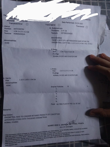 Result po ng trans V ko.