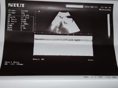 pelvic ultrasound