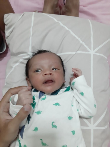 ท้องอืด