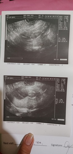 Ultrasound