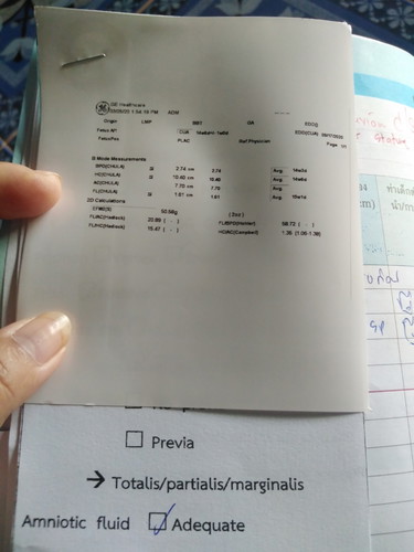 ซาวด์แต่งง