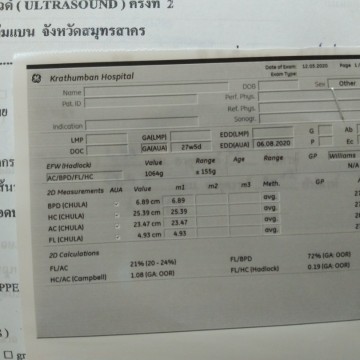 น้ำหนักลูก