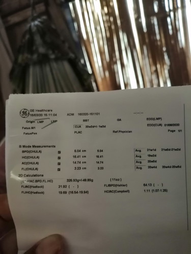 ท้องแรกค่ะ