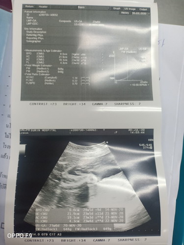 ลูกผู้หญิงหรือชาย
