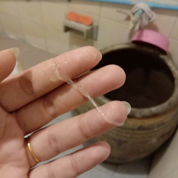 มูกใส 38+4วีค