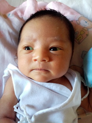 Normal Ba Ang Naninilaw Na Mga Mata Ni Baby