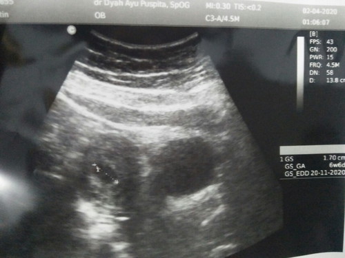 assalamualaikum wr.wb bunda bunda semuanya selamat mlm.. saya td sore baru aja usg. alhamdulillah saya hamil mau 7 minggu. semoga bunda bunda jg sehat dan janin nya juga sehat aminnn
