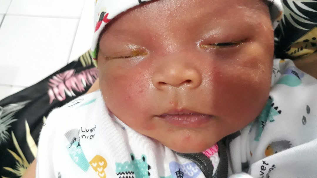 bayi 13 hari belekan