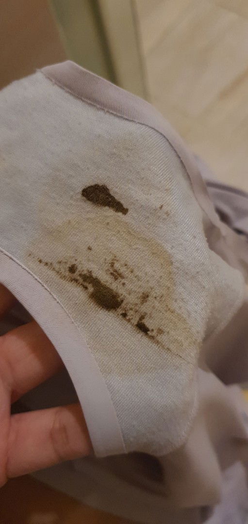 flek hitam di minggu ke 8