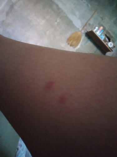 naniniwala po ba kayo sa kambal buntis?