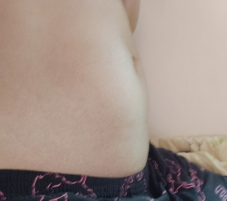 20wk.มาครึ่งทางแล้ววว