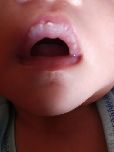 seputar bayi