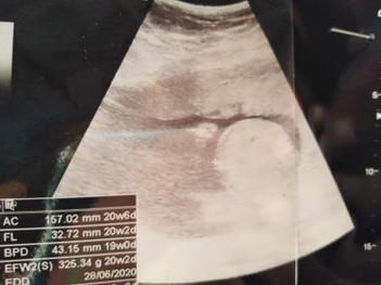 ถามแม่ๆค่ะ