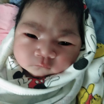 ทำหมัน