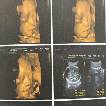 30w