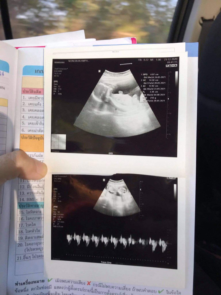 katong​ profile icon