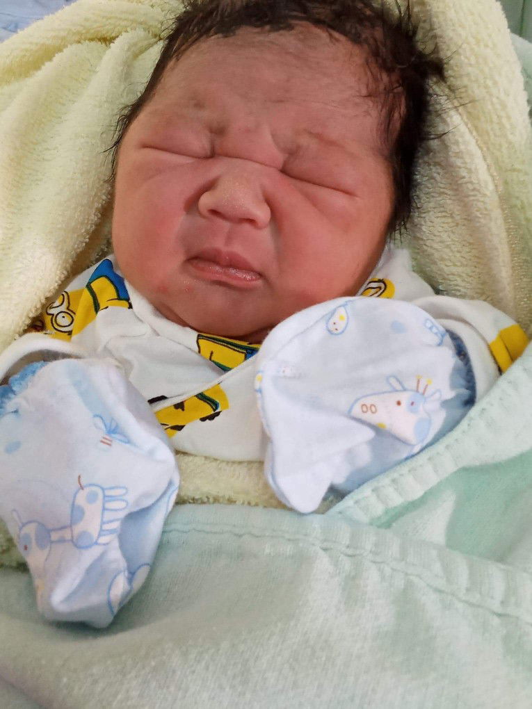 เด็กเพิ่งคลอดลิ้นติดเป็นผังผืดใต้ลิ้น