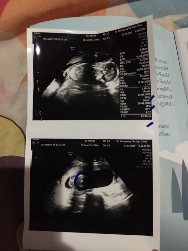 Thanchanok Limwong profile icon