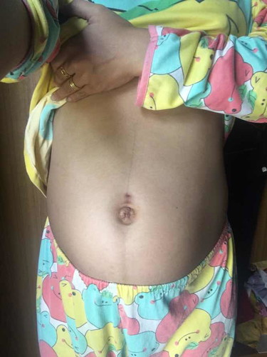 26w5d เด็กผู้ชายของแม่??