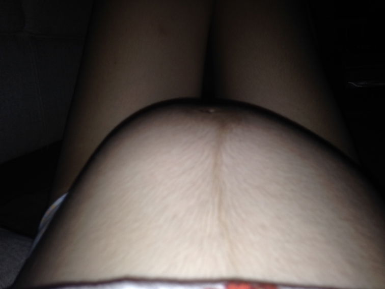 Baby bump