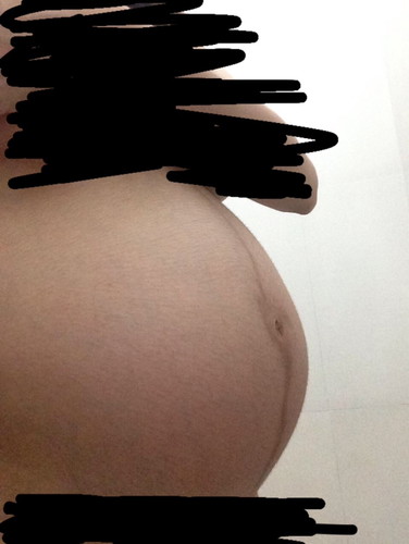 Baby bump