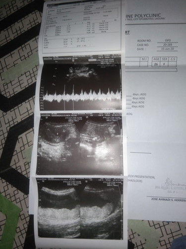 pelvic ultrasound
