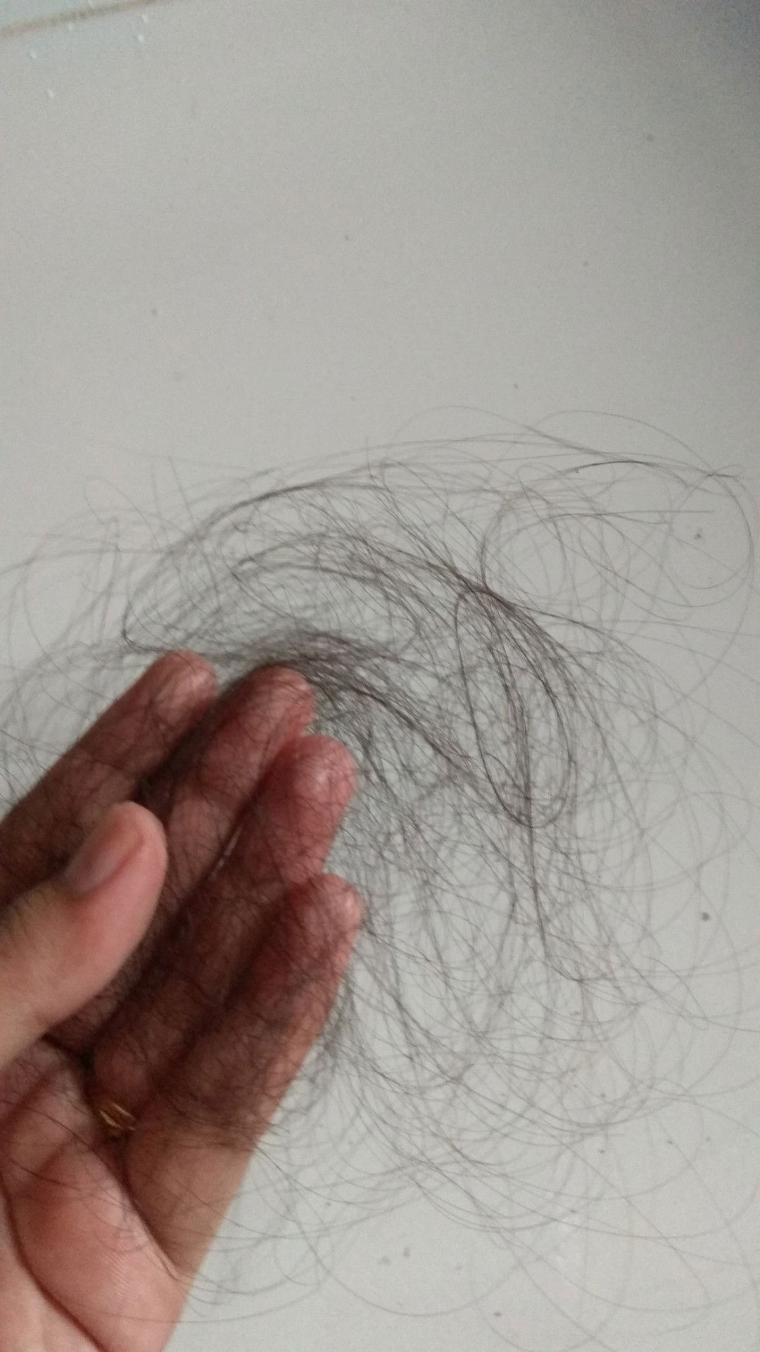 Mengatasi Rambut Rontok Ketika Asi