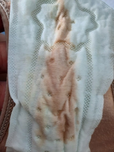 ผิดปกติ