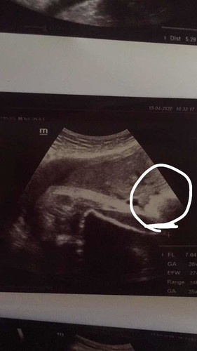 เหมือนหน้าไหมคะ