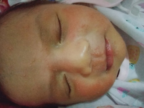 ทำไงหาย